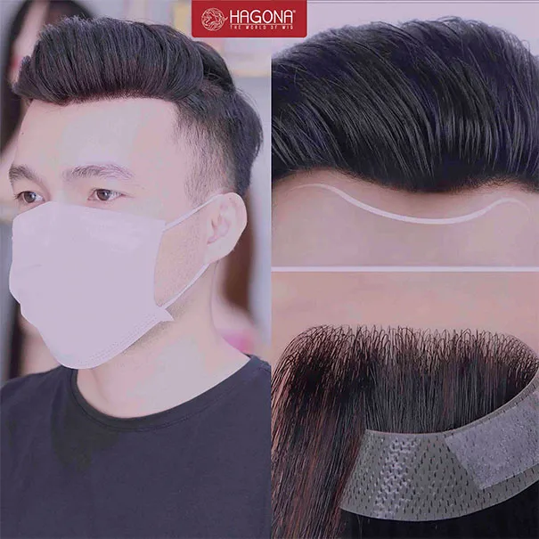 Ảnh sản phẩm Tóc mái hói chữ M nam