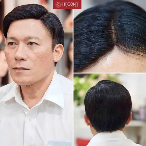 Ảnh sản phẩm Tóc mái hói nam trung niên kiểu tóc cổ điển lvy League