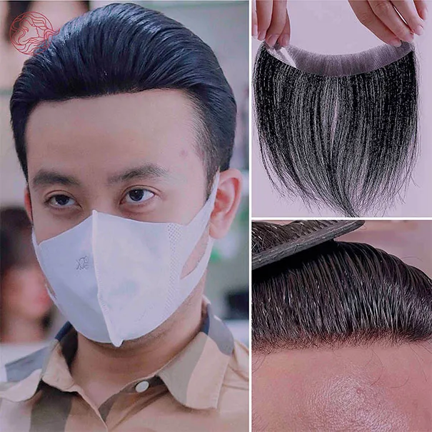 Ảnh sản phẩm Tóc dán mái hói chữ MS