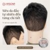 Tóc giả nam nguyên đầu siêu da đầu