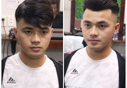 Lấy lại phong độ nhờ tóc giả cho nam bị hói