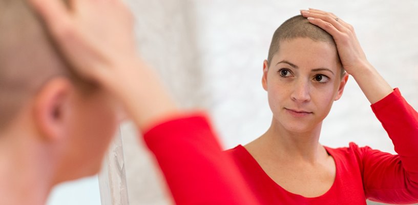 Cách ngăn ngừa rụng tóc đối đa trong thời gian hóa trị