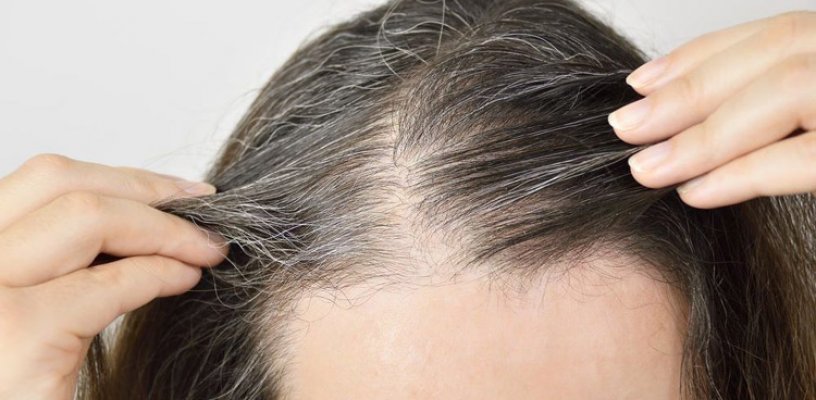Nguyên nhân khiến tóc bạc sớm là gì? Cách khắc phục tình trạng tóc bạc sớm ở người trẻ