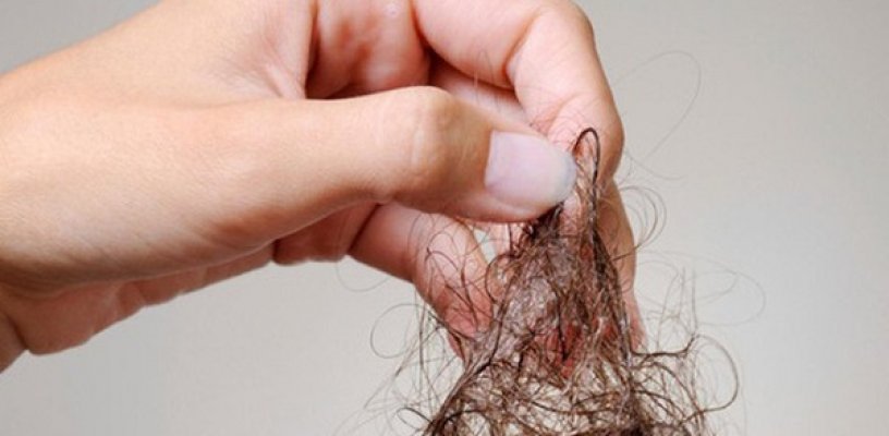 Nguyên nhân nào dẫn đến tóc rụng bất thường?