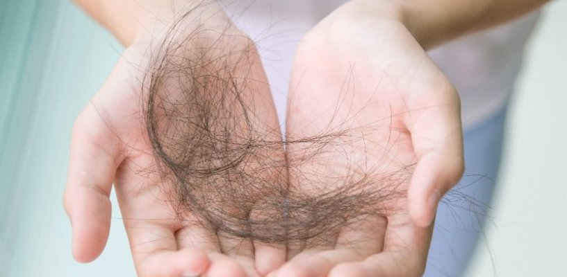 Hậu Covid bị rụng tóc: Nguyên nhân và cách khắc phục hiệu quả