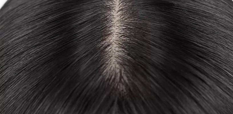 Công nghệ tóc giả siêu da đầu là gì?