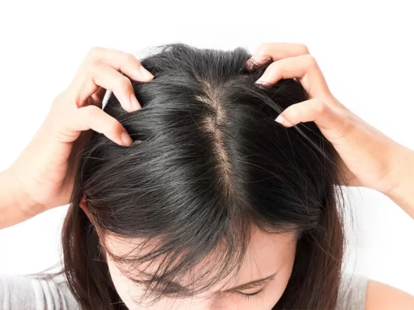 Cách điều trị da đầu khô và tóc dầu hiệu quả