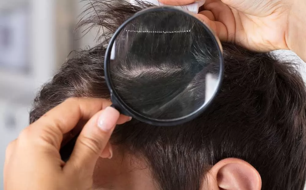 Bạn đã biết tóc mọc thế nào chưa?