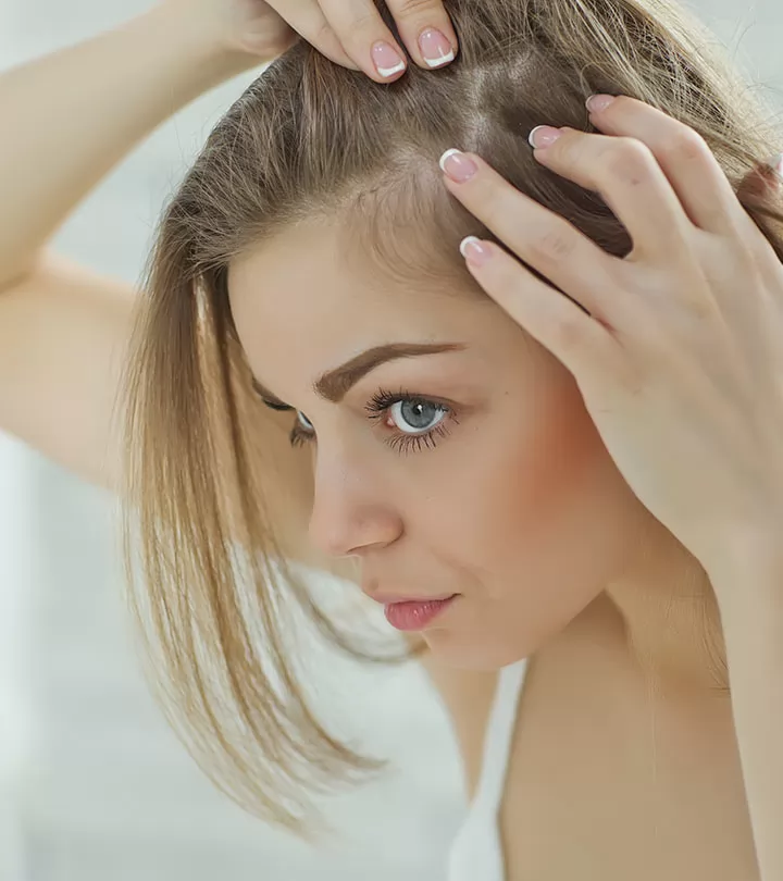 8 Cách Đơn Giản Trị Rụng Tóc Ở Thái Dương