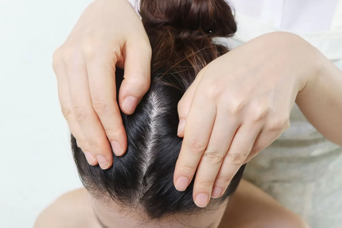 Đổ mồ hôi có dẫn đến rụng tóc không? Cách bảo vệ tóc khi đổ mồ hôi