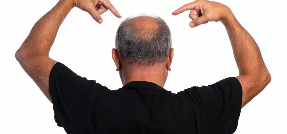 Hướng dẫn cách đo from tóc giả chi tiết tại Hagona