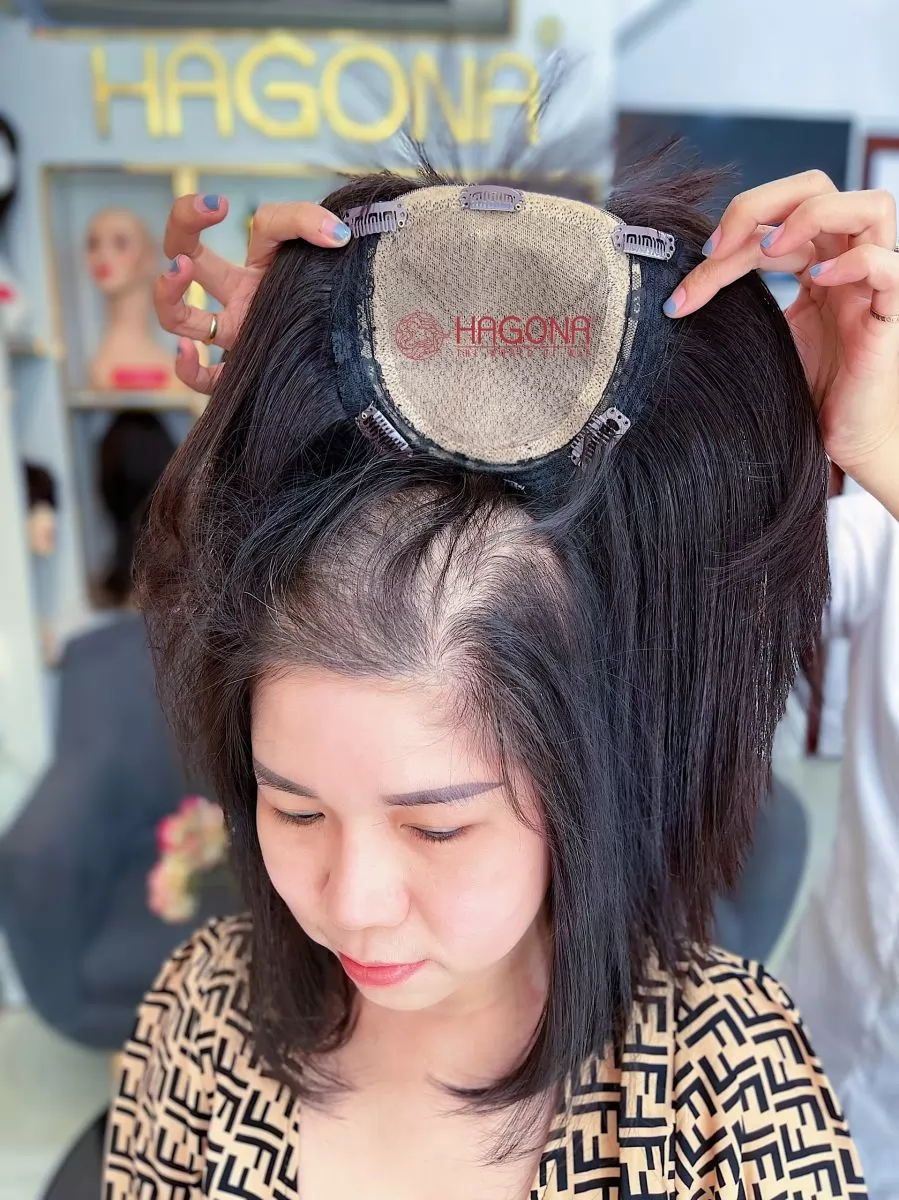 Nguyên nhân rụng tóc thời kỳ mãn kinh và cách khắc phục