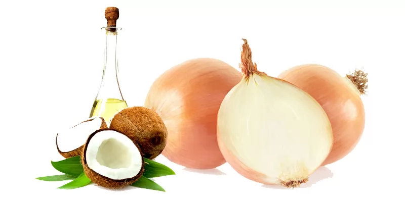 Top 5 cách trị rụng tóc từ nước ép hành tây đơn giản và hiệu quả tại nhà