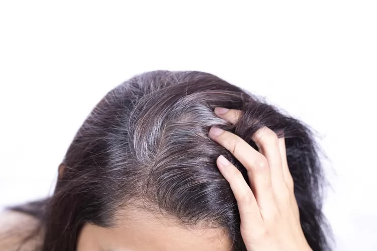 Cách điều trị tóc bạc sớm: Nguyên nhân, cách chữa và mẹo ngăn ngừa