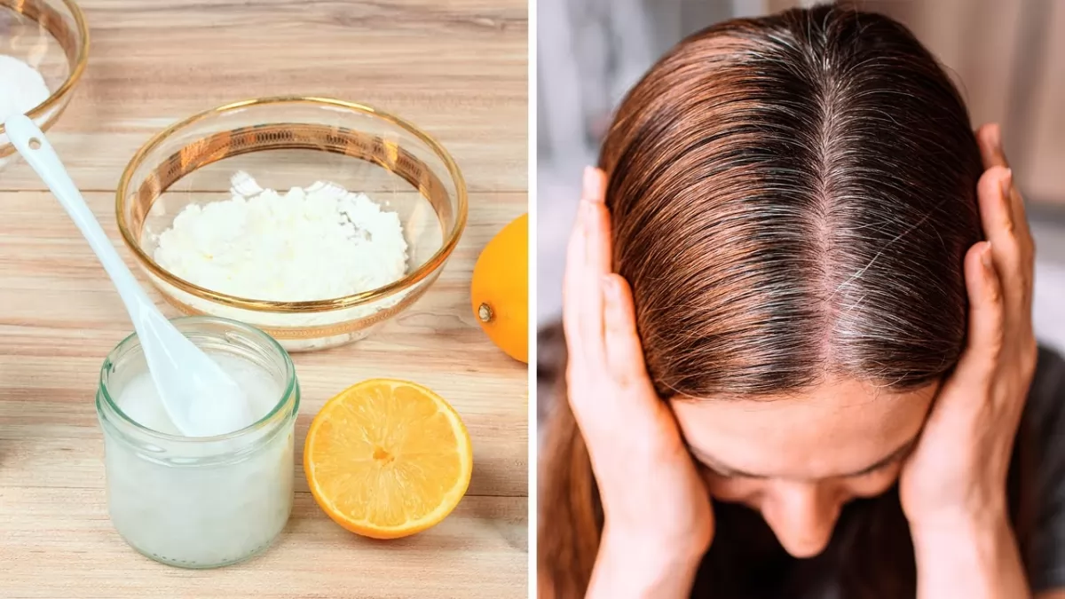 Cách trị gàu trong mùa đông hiệu quả tại nhà từ thiên nhiên