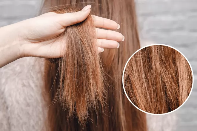 5 cách khắc phục tóc bị cháy nắng ngày hè nhanh chóng