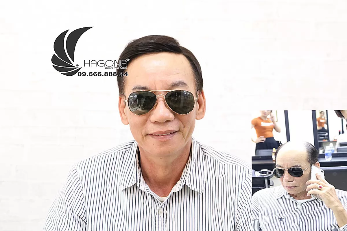 Trẻ ra 10 tuổi nhờ tóc giả cho nam đầu hói