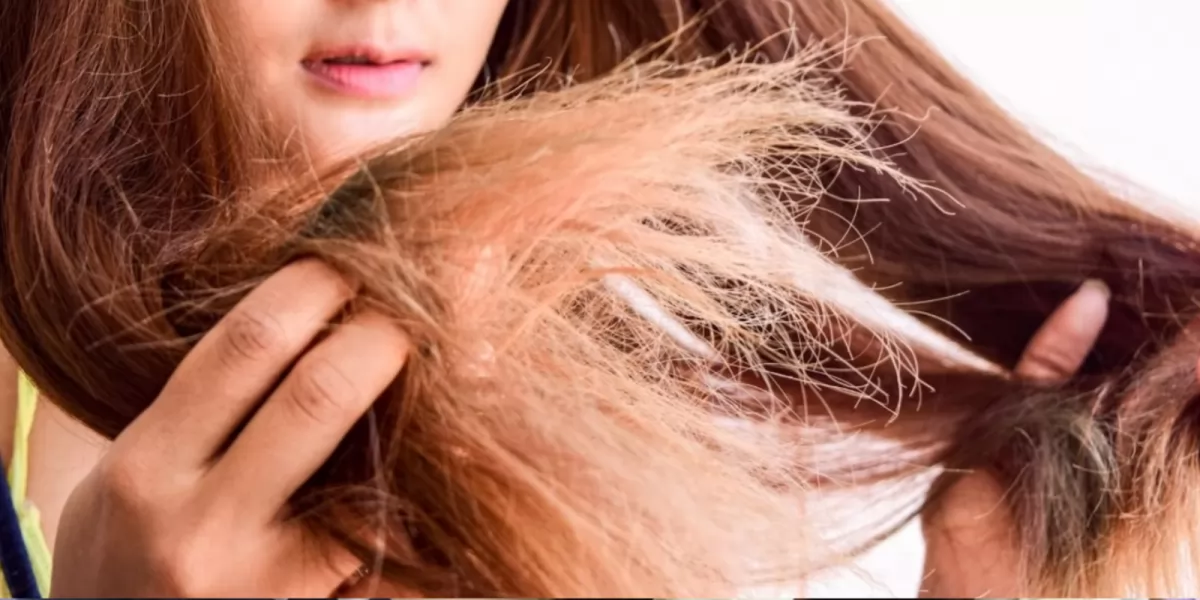 Nguy Cơ Tóc Rụng Lả Tả Vì Nắng: 6 Dấu Hiệu Không Thể Bỏ Qua!