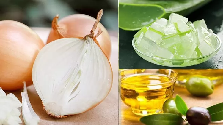 Top 5 cách trị rụng tóc từ nước ép hành tây đơn giản và hiệu quả tại nhà