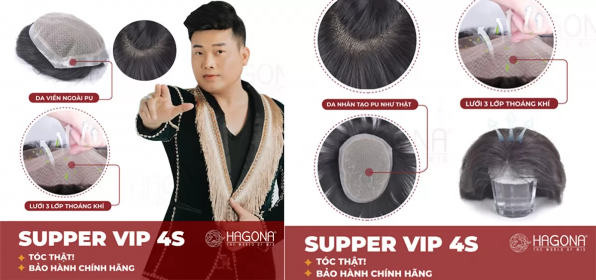 Mái hói siêu da đầu 4S viền Poly xung quanh dán keo gắn kẹp