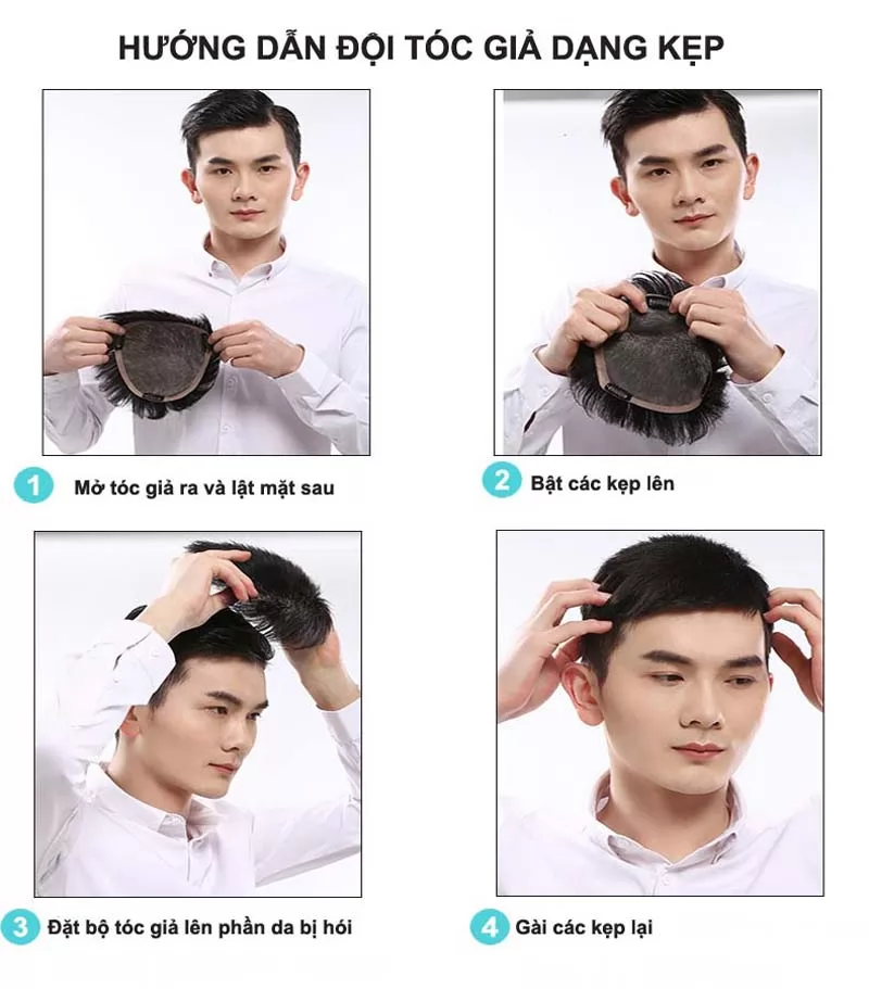 Vì sao nên sử dụng tóc giả cho người hói? 7 loại tóc giả che hói phổ biến nhất hiện nay