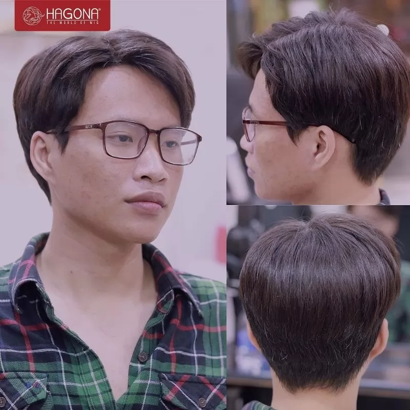 tóc giả cho nam bị hói