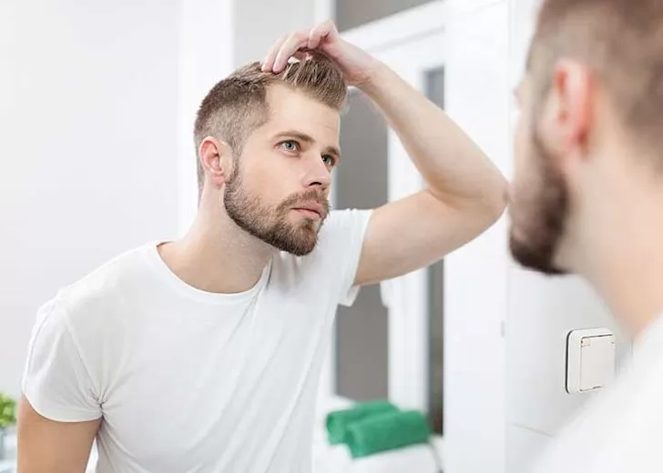 Tóc rụng nhiều ở nam giới là hiện tượng gì?