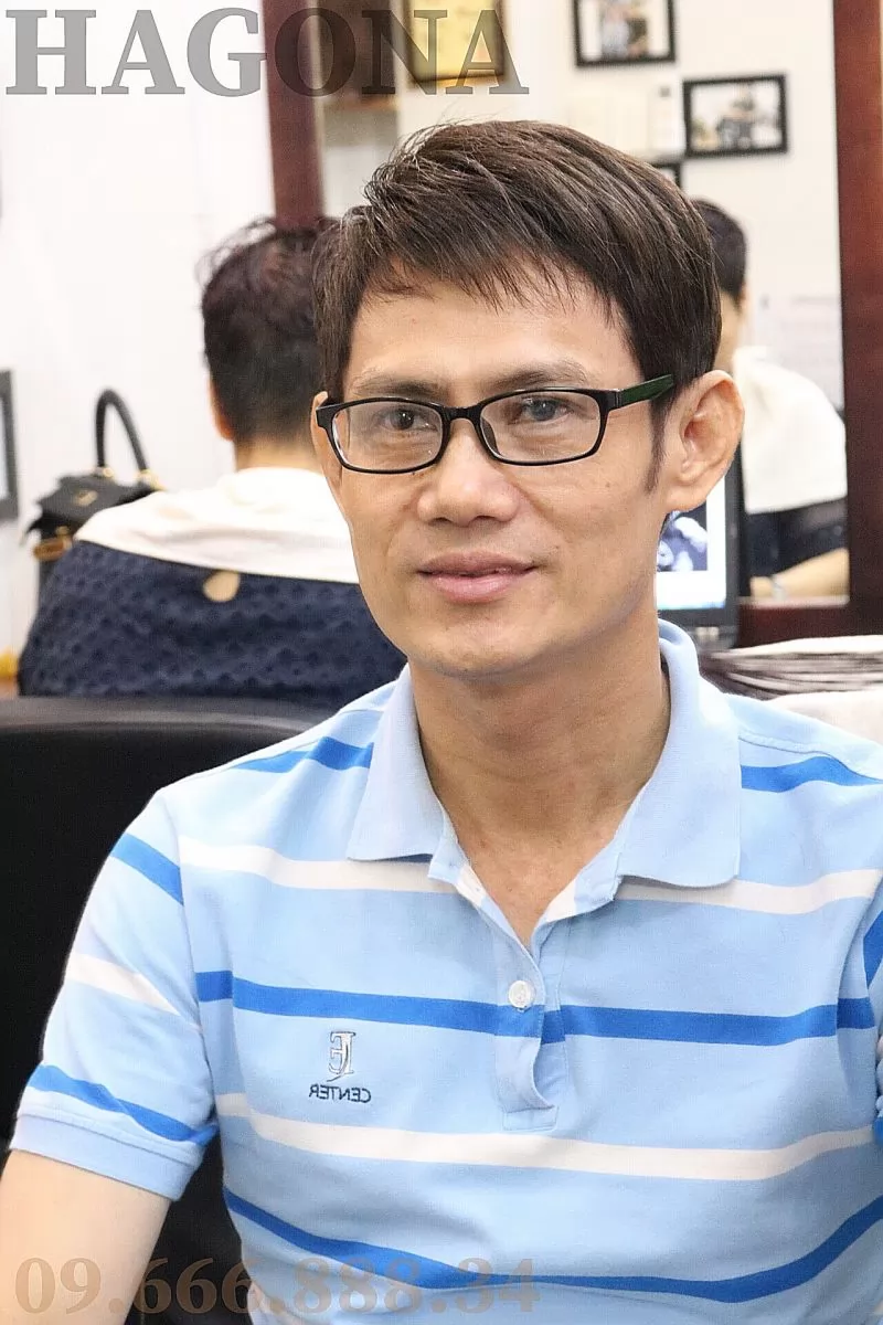 tóc mái hói nam có da đầu cho người hói