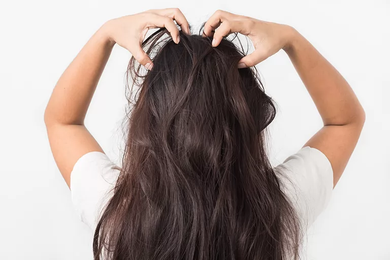 14 cách trị ngứa da đầu từ thiên nhiên tại nhà