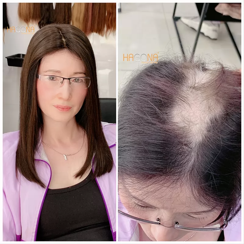 Hướng dẫn lựa chọn và đội tóc giả mái hói nữ CHI TIẾT