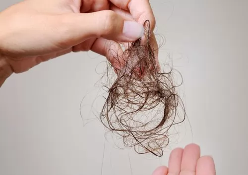Trị gàu: 5 triệu chứng của tóc gàu và cách điều điều trị cơ bản