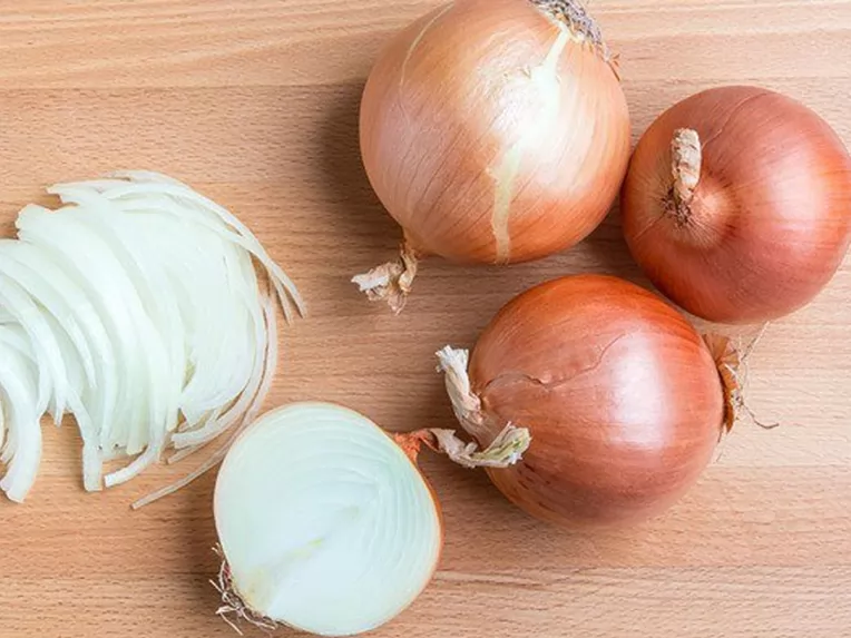 Top 5 cách trị rụng tóc từ nước ép hành tây đơn giản và hiệu quả tại nhà
