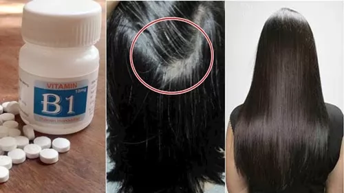 Vitamin B1 có trị rụng tóc không?