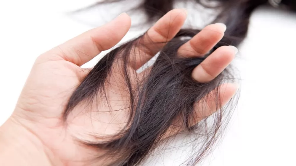 Tìm hiểu về nguyên nhân rụng tóc ở phụ nữ chi tiết nhất