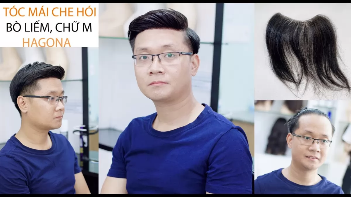Review tóc giả mái hói chữ M cho nam trán cao của Hagona 