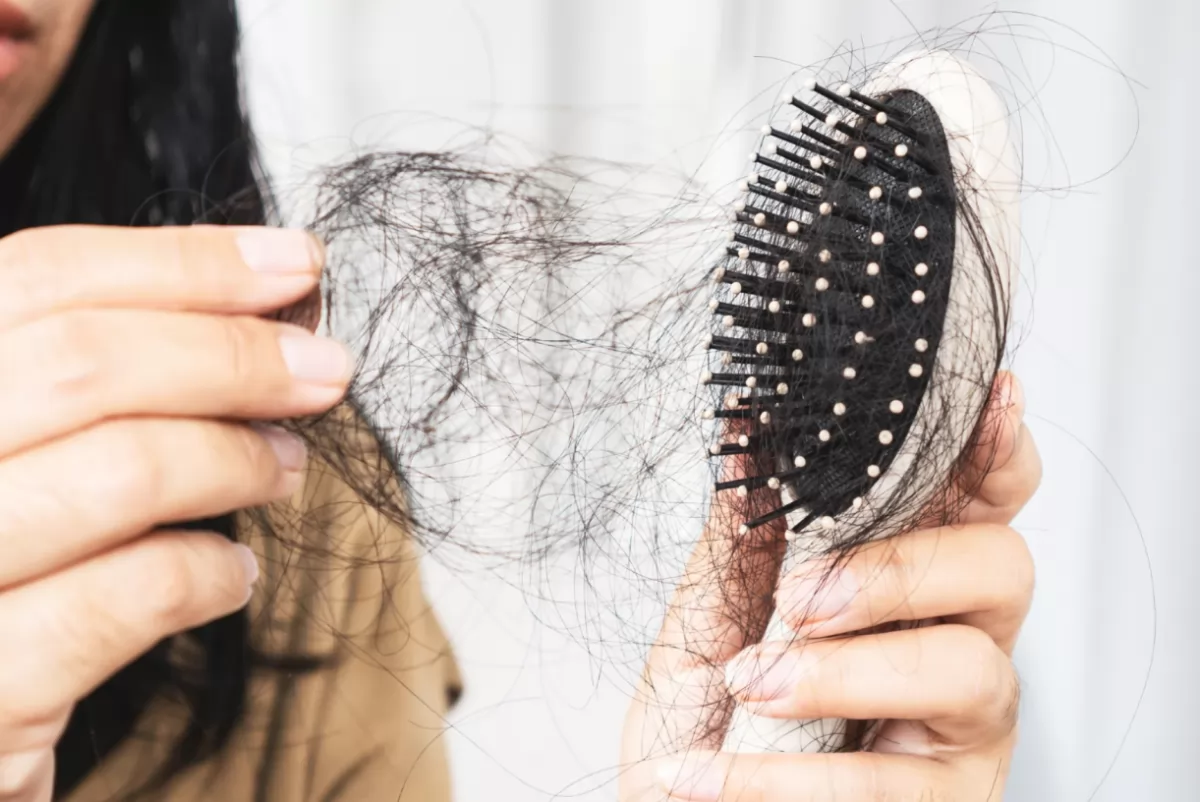 Tóc rụng nhiều trên lược