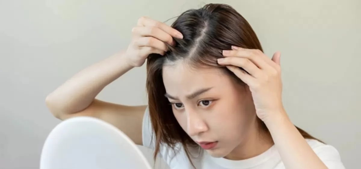 Lưu ngay các cách để tóc không bết hiệu quả tức thì