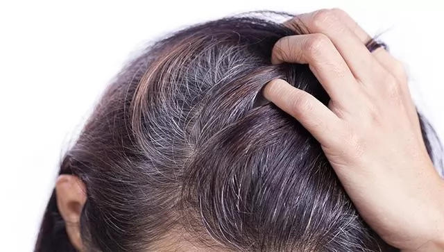 Nguyên nhân khiến tóc bạc sớm là gì? Cách khắc phục tình trạng tóc bạc sớm ở người trẻ