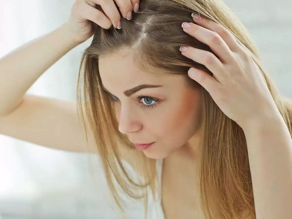Thế nào là bệnh rụng tóc do thiếu sắt?