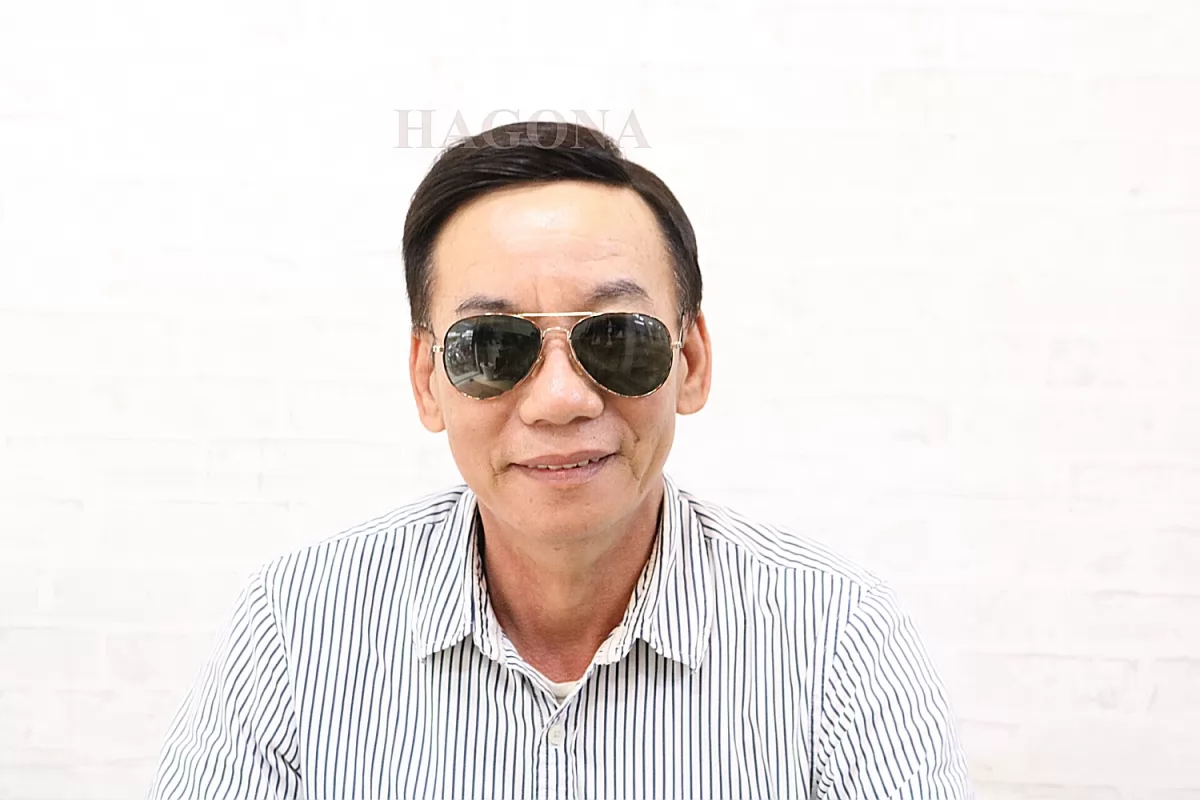 miếng dán che hói