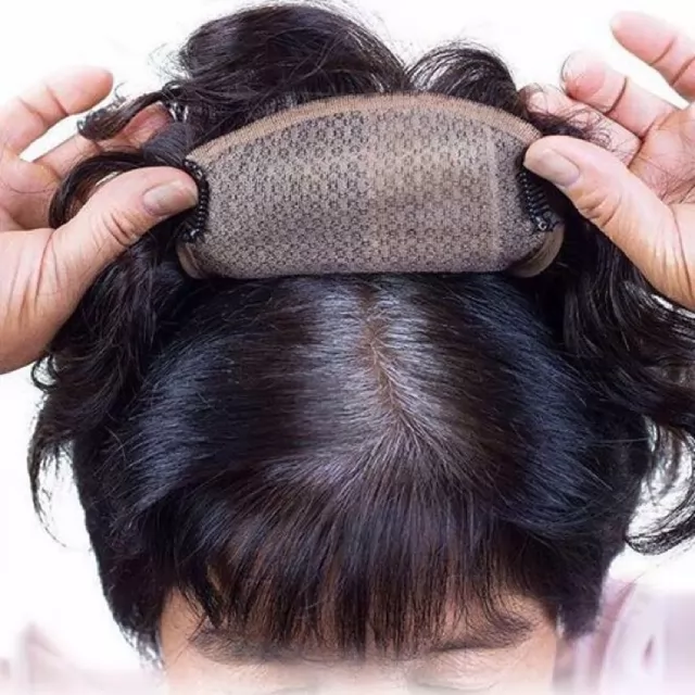 Nguyên nhân khiến tóc bạc sớm là gì? Cách khắc phục tình trạng tóc bạc sớm ở người trẻ