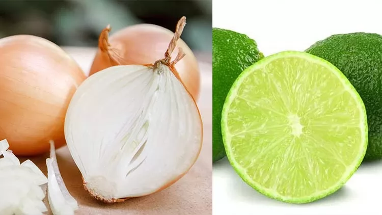 Top 5 cách trị rụng tóc từ nước ép hành tây đơn giản và hiệu quả tại nhà