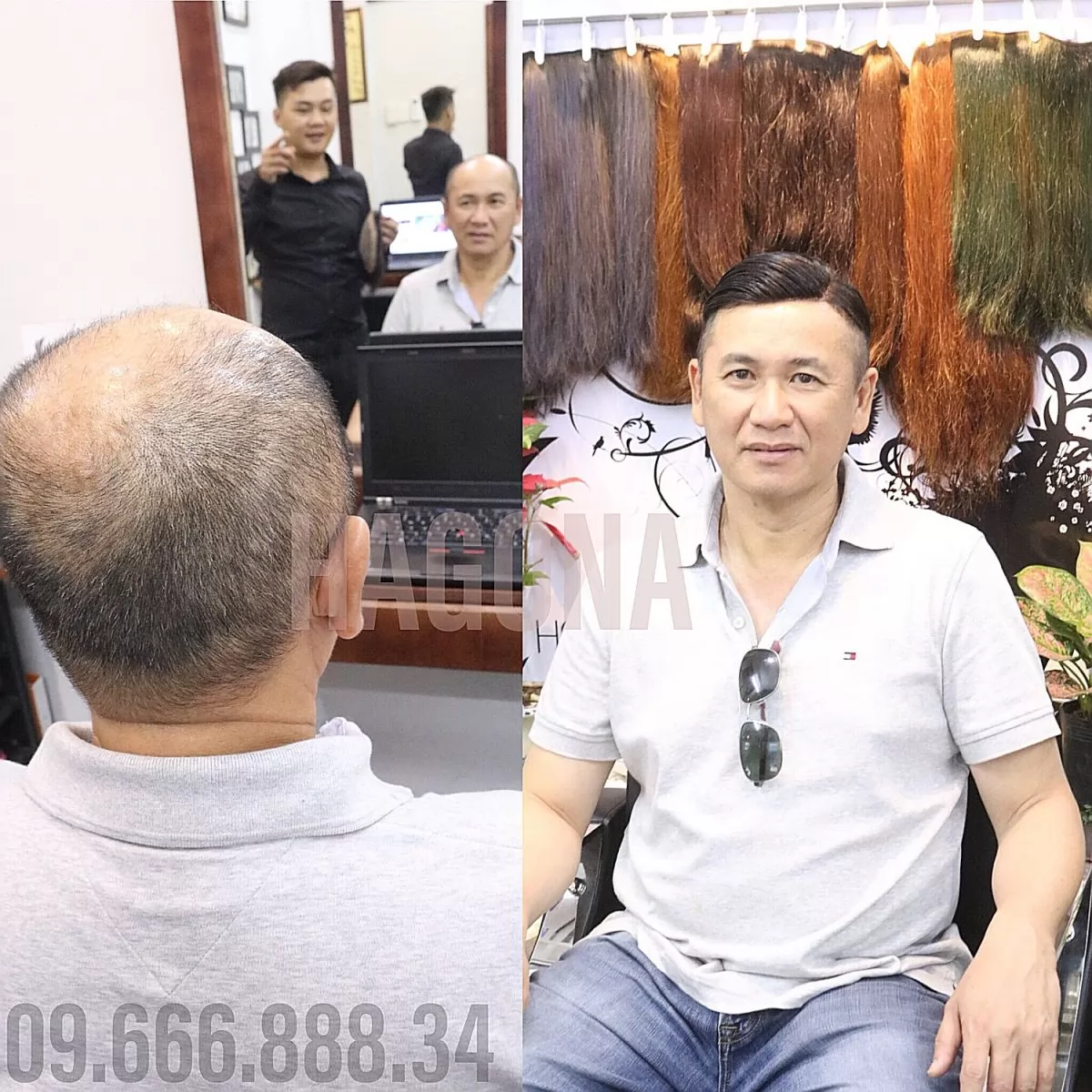 kiểu tóc mái hói nam trung niên