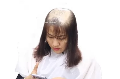 tóc giả bằng tóc thật có da đầu 2