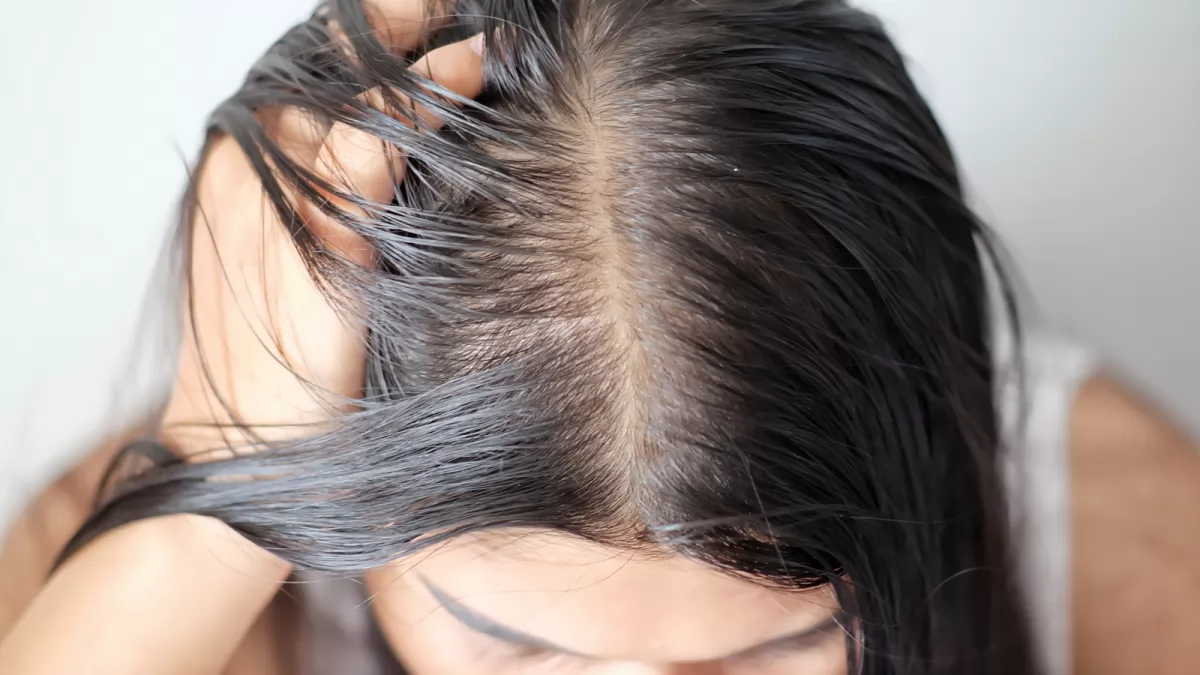 12 lý do tại sao tóc của bạn ngừng phát triển