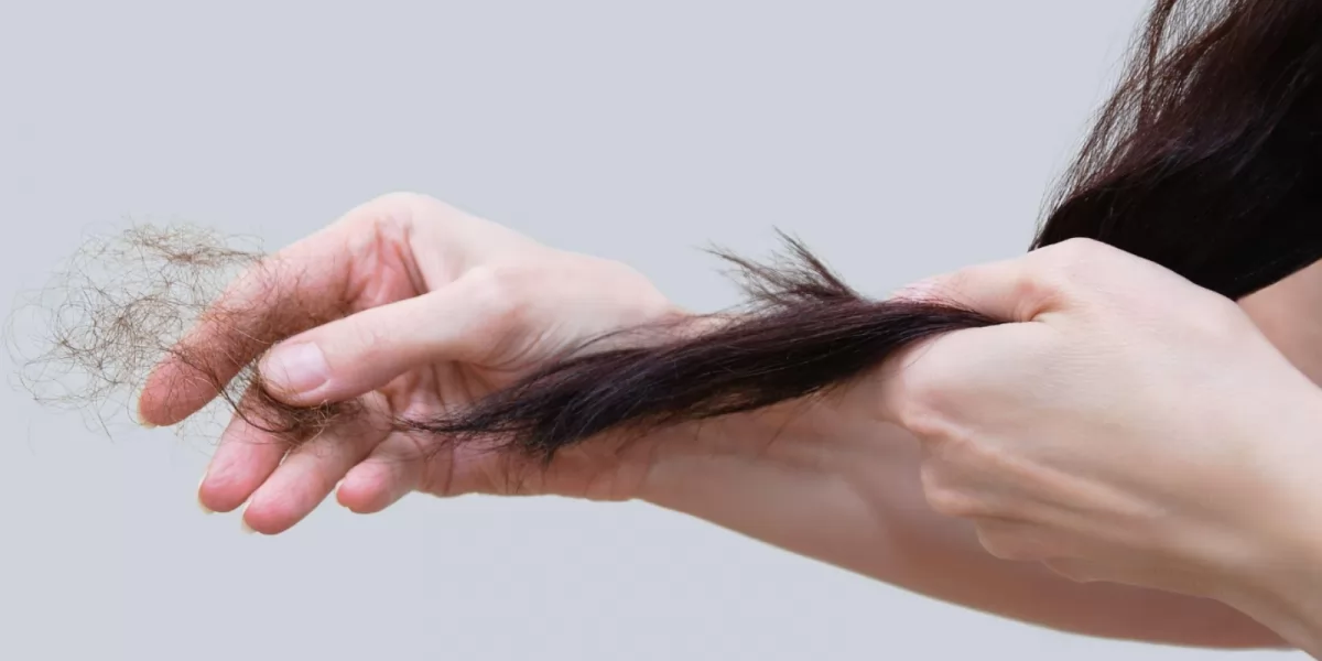 Mùa Rụng Tóc Là Mùa Nào, Vào Tháng Mấy? Cách Khắc Phục Hiệu Quả Nhất