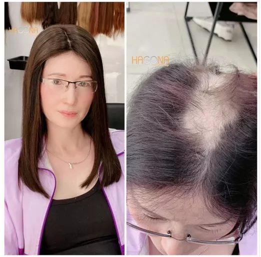 Tóc giả che hói HGN H03