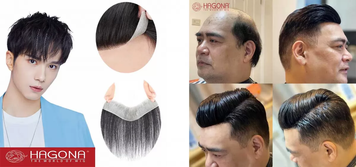 Tóc dán mái hói là gì? Hướng dẫn cách sử dụng tóc dán mái hói