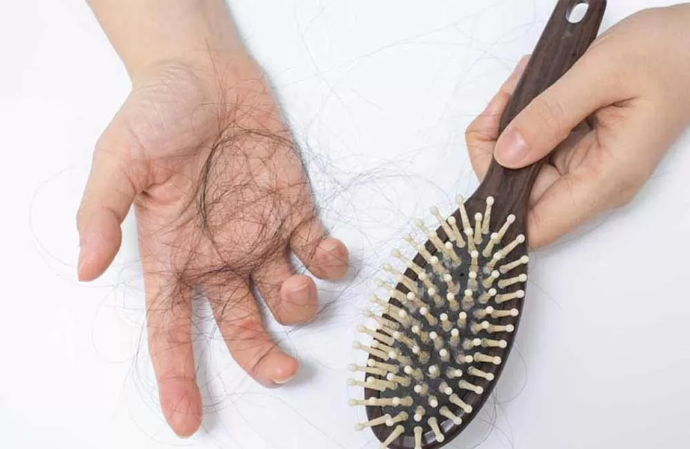 Thế nào là bệnh rụng tóc do thiếu sắt?