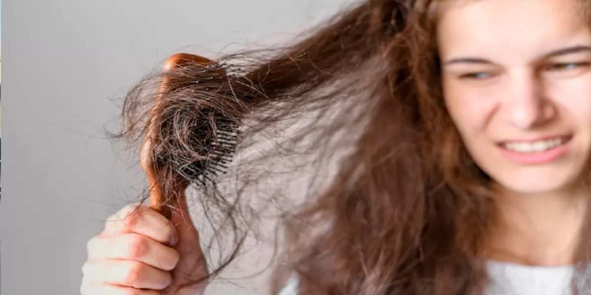 Tóc bông xù là gì? 5 mẹo chăm sóc mái tóc bông xù khó vào nếp